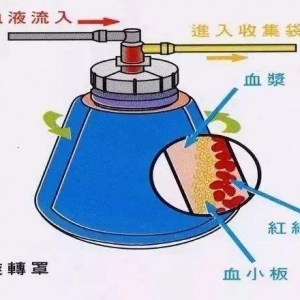 xʽѪҺɷַxO(sh)Ru(png)r(ji)עԼg(sh)ָ(do)ԭt