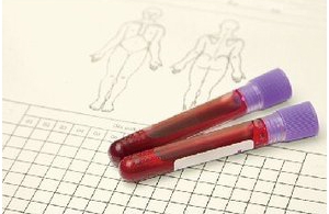 CYP2C19ˎxøB(ti)ԙzy(c)ԇע(c)g(sh)ָ(do)ԭt